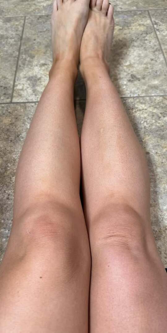 After — Before and after results — buildable sun-kissed glow with YEOUTH Tanning Drops