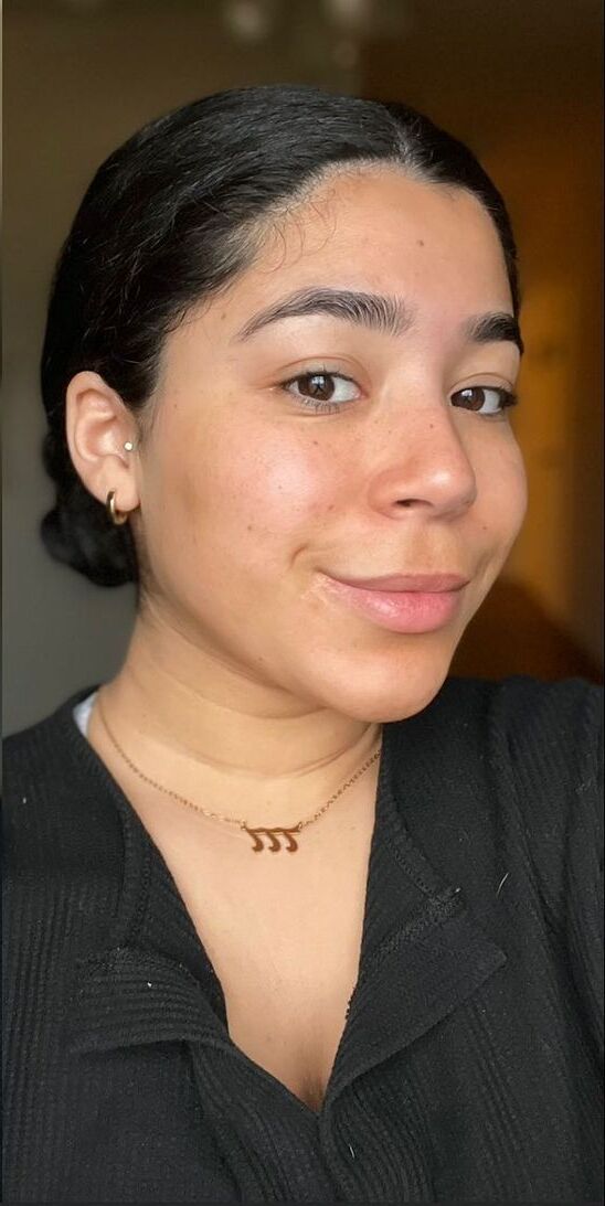 After — Skin transformation — before and after YEOUTH Self Tanning Drops