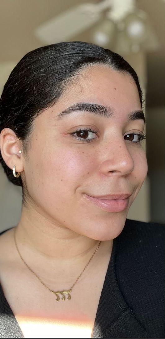 Before — Skin transformation — before and after YEOUTH Self Tanning Drops