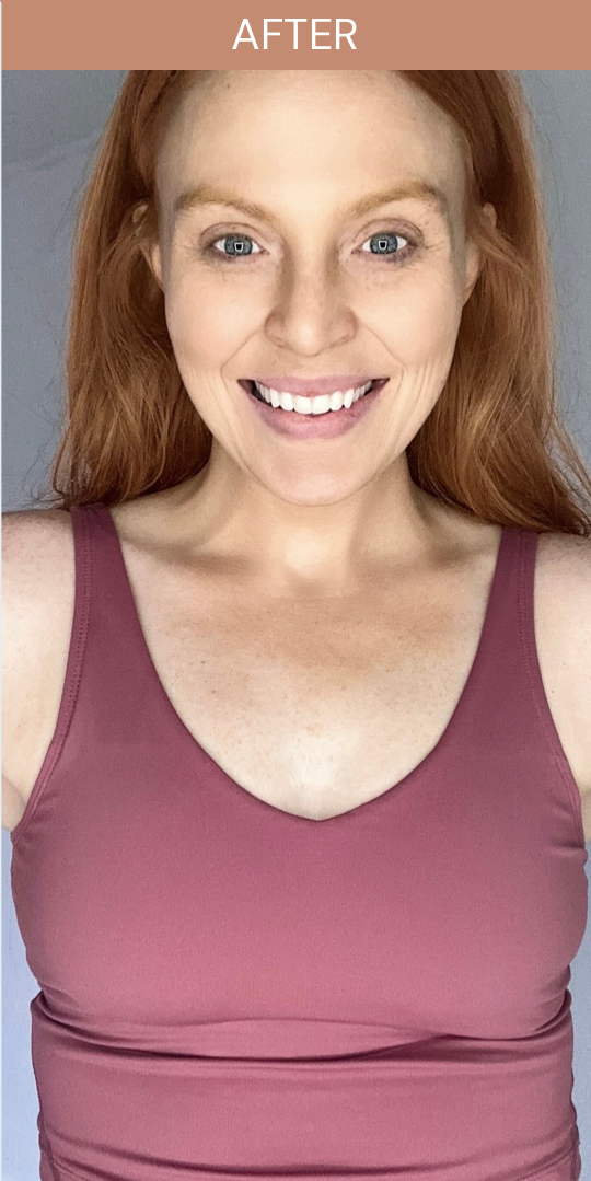 After — Customer results — radiant bronze tan with YEOUTH Self Tanning Drops